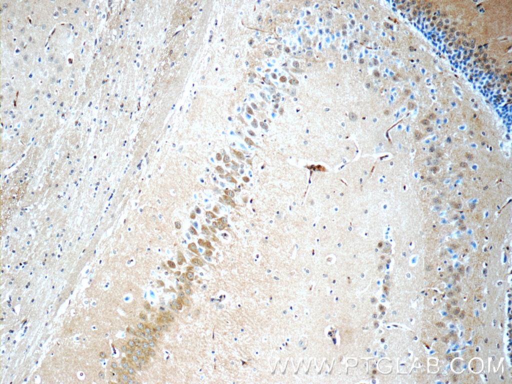 Immunohistochemistry (IHC) staining of mouse brain tissue using CDK5RAP1 Polyclonal antibody (14740-1-AP)