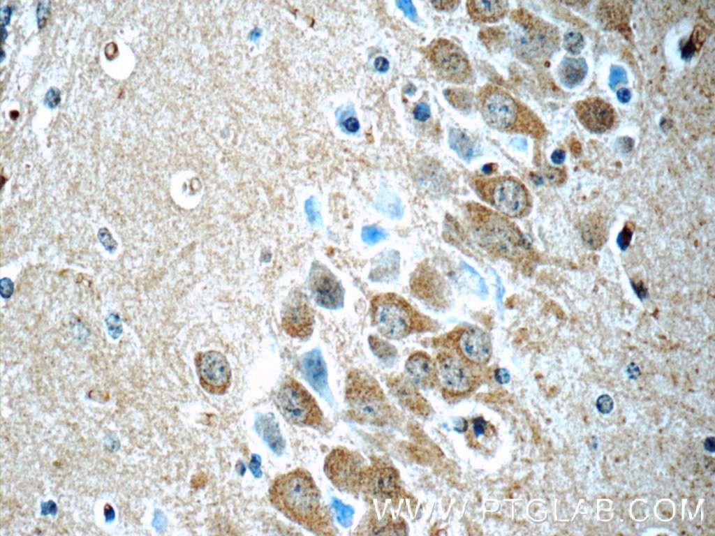 Immunohistochemistry (IHC) staining of mouse brain tissue using CDK5RAP1 Polyclonal antibody (14740-1-AP)