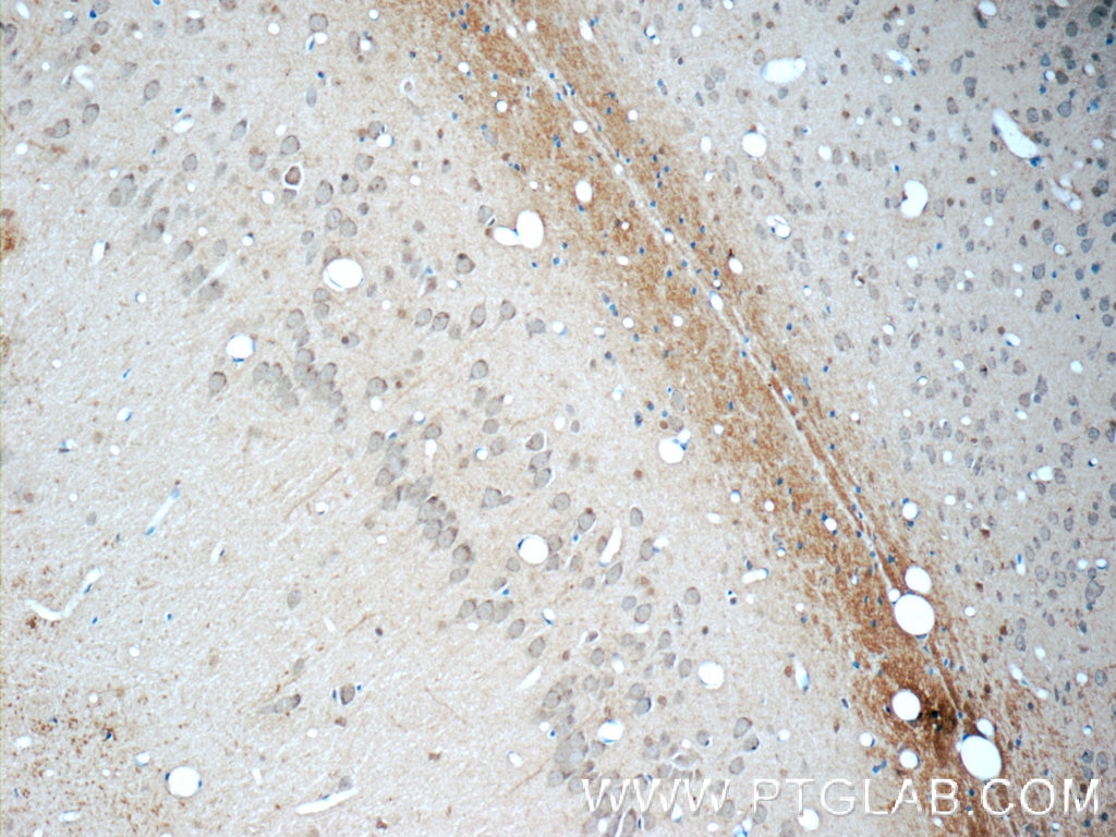 Immunohistochemistry (IHC) staining of rat brain tissue using CDK5RAP1 Polyclonal antibody (14740-1-AP)