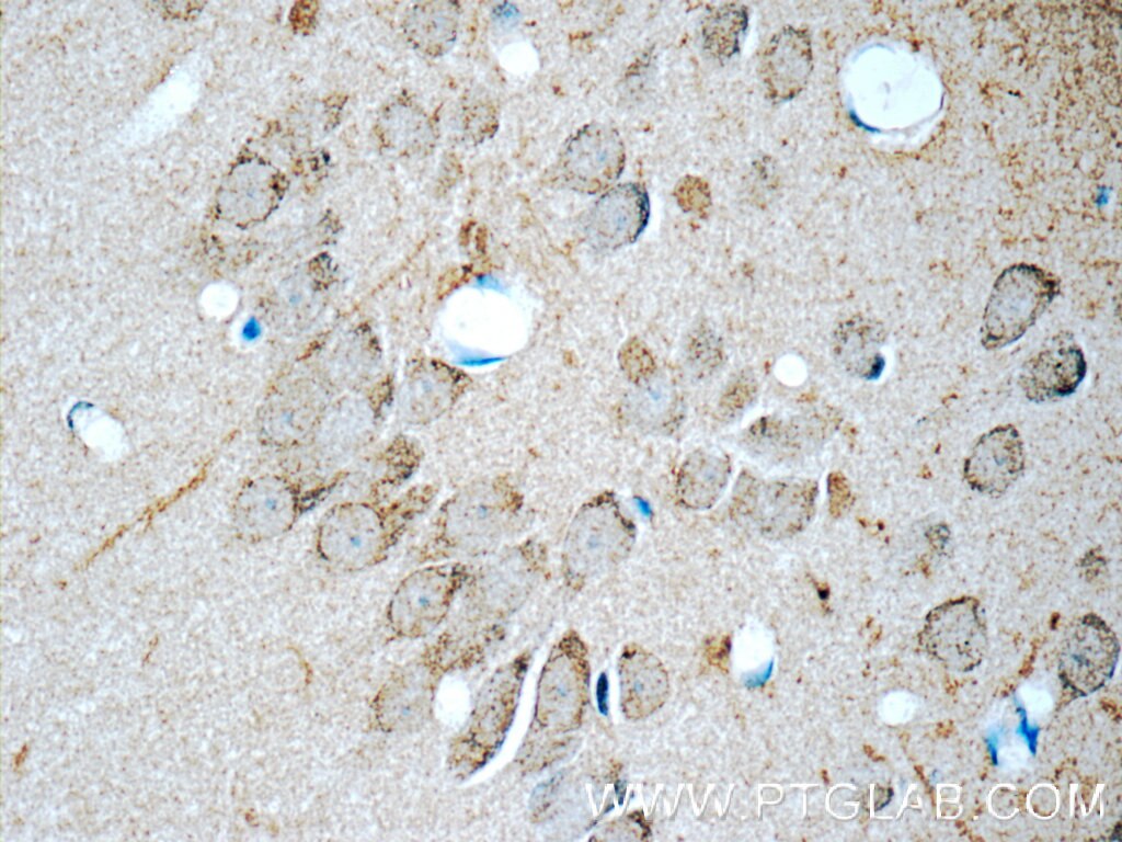 Immunohistochemistry (IHC) staining of rat brain tissue using CDK5RAP1 Polyclonal antibody (14740-1-AP)