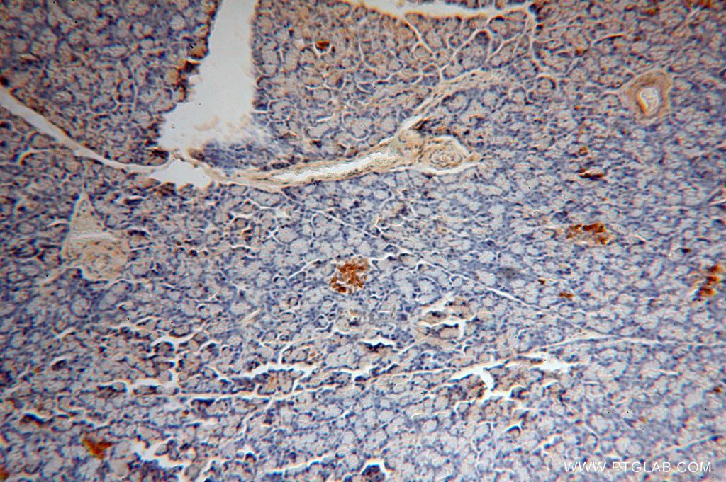 Immunohistochemistry (IHC) staining of human pancreas tissue using CDK5RAP1 Polyclonal antibody (14740-1-AP)