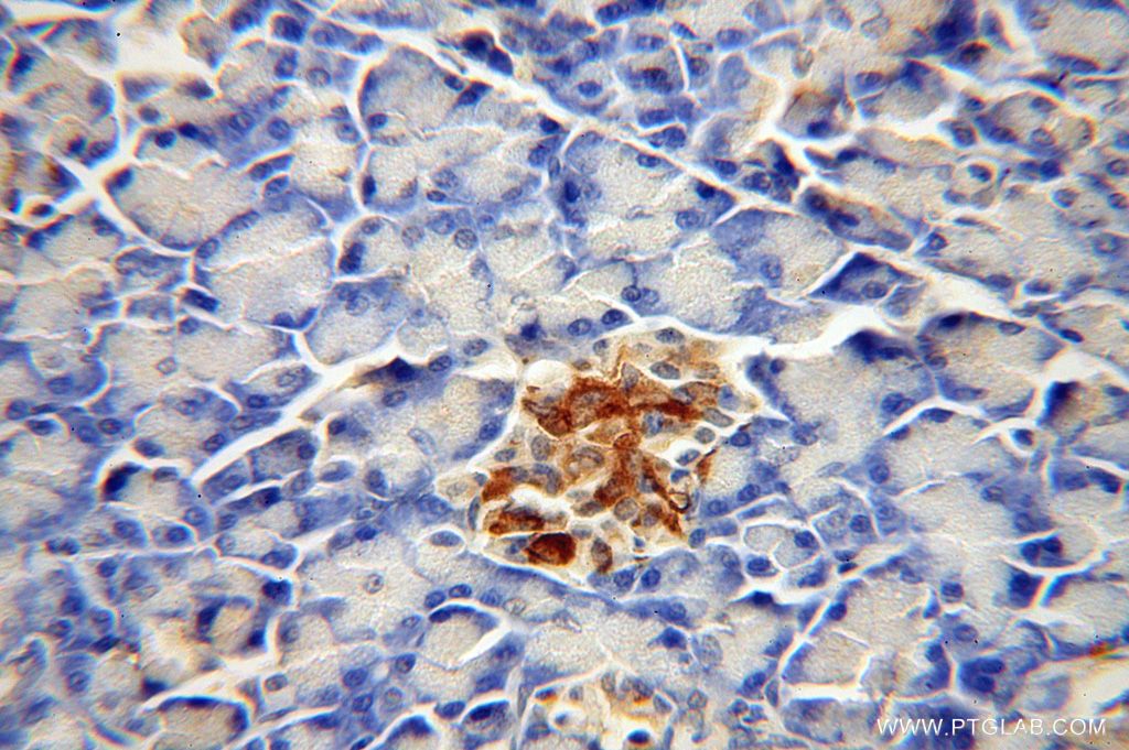 Immunohistochemistry (IHC) staining of human pancreas tissue using CDK5RAP1 Polyclonal antibody (14740-1-AP)