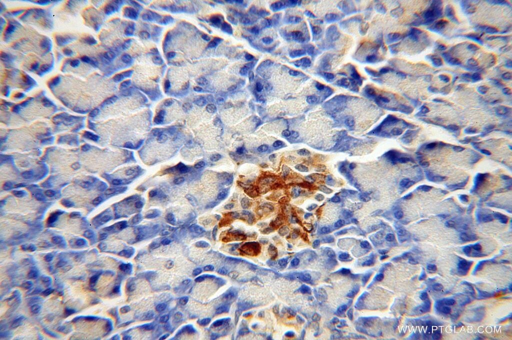 IHC staining of human pancreas using 14740-1-AP