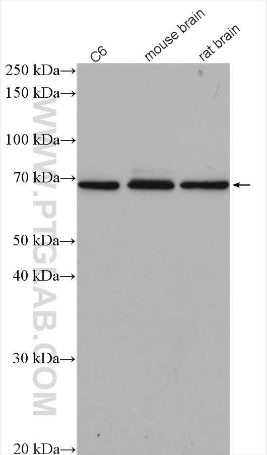 Western Blot (WB) analysis of various lysates using CDK5RAP1 Polyclonal antibody (14740-1-AP)