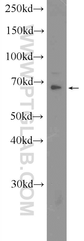 Western Blot (WB) analysis of mouse brain tissue using CDK5RAP1 Polyclonal antibody (14740-1-AP)