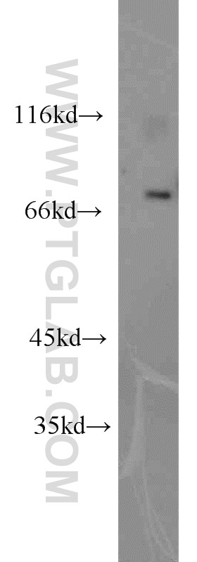 Western Blot (WB) analysis of human heart tissue using CDK5RAP1 Polyclonal antibody (14740-1-AP)