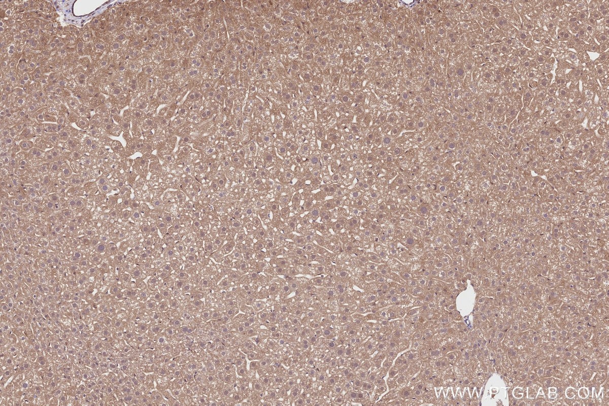 IHC staining of mouse liver using 31702-1-AP Immunohistochemistry (IHC) staining of mouse liver tissue using CDK5RAP2 Polyclonal antibody (31702-1-AP)