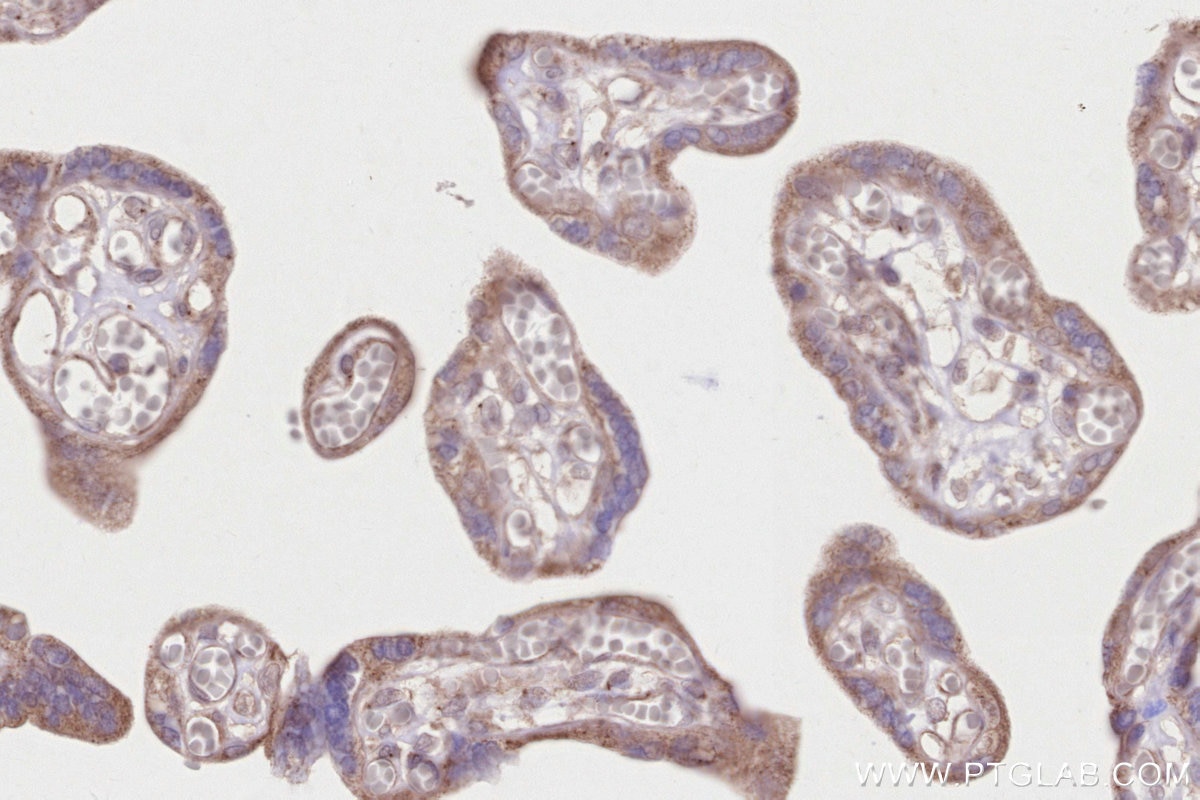 IHC staining of human placenta using 31702-1-AP Immunohistochemistry (IHC) staining of human placenta tissue using CDK5RAP2 Polyclonal antibody (31702-1-AP)