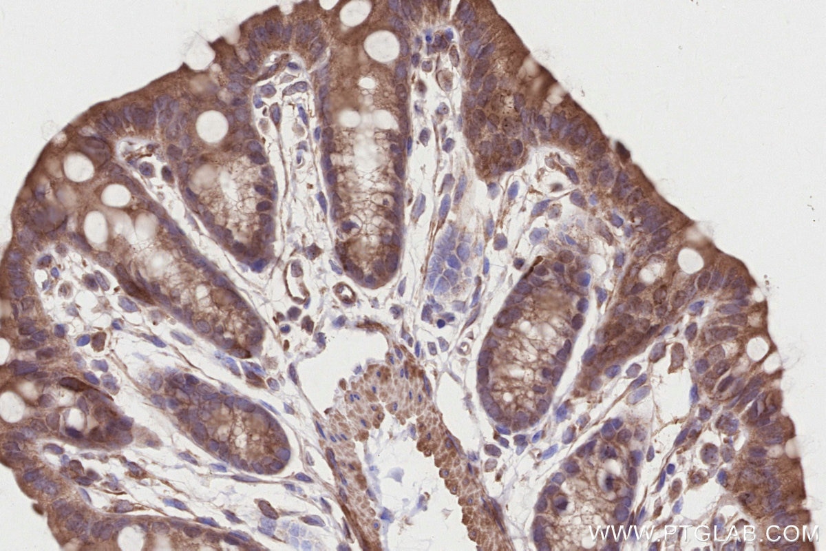 IHC staining of mouse colon using 31702-1-AP Immunohistochemistry (IHC) staining of mouse colon tissue using CDK5RAP2 Polyclonal antibody (31702-1-AP)