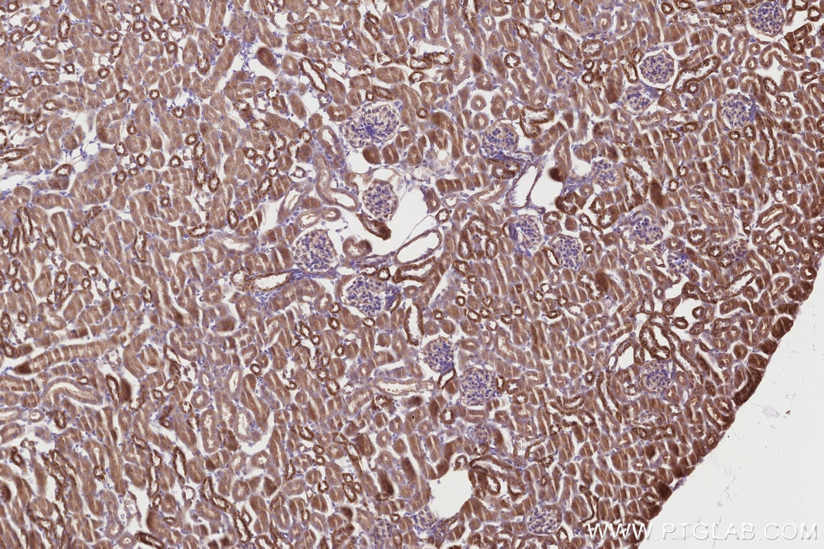 IHC staining of mouse kidney using 31702-1-AP Immunohistochemistry (IHC) staining of mouse kidney tissue using CDK5RAP2 Polyclonal antibody (31702-1-AP)