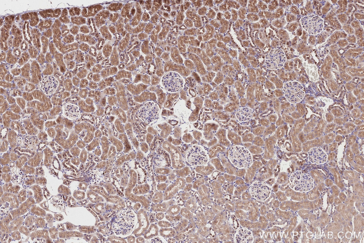 IHC staining of rat kidney using 31702-1-AP Immunohistochemistry (IHC) staining of rat kidney tissue using CDK5RAP2 Polyclonal antibody (31702-1-AP)