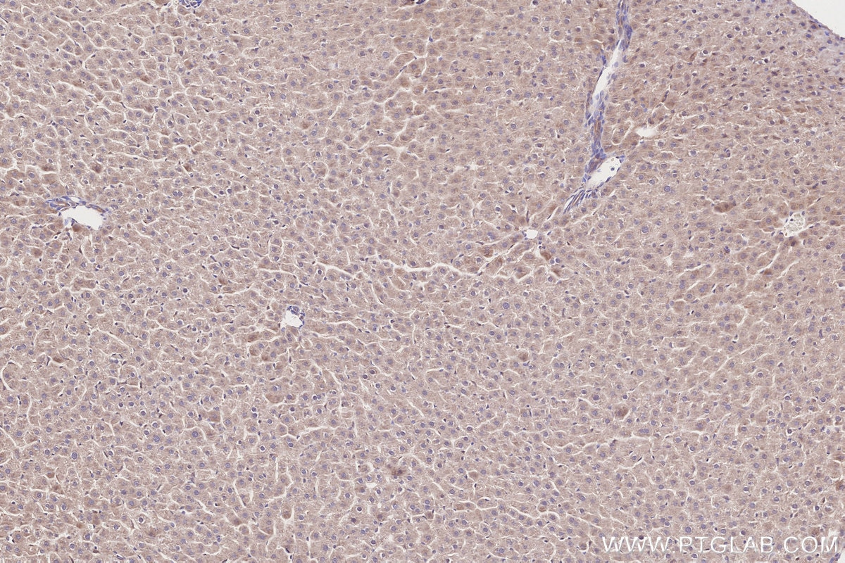 IHC staining of rat liver using 31702-1-AP Immunohistochemistry (IHC) staining of rat liver tissue using CDK5RAP2 Polyclonal antibody (31702-1-AP)