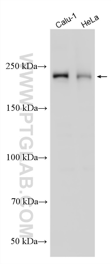 WB analysis using 31702-1-AP (same clone as 31702-1-PBS) Western Blot (WB) analysis of various lysates using CDK5RAP2 Polyclonal antibody (31702-1-AP)