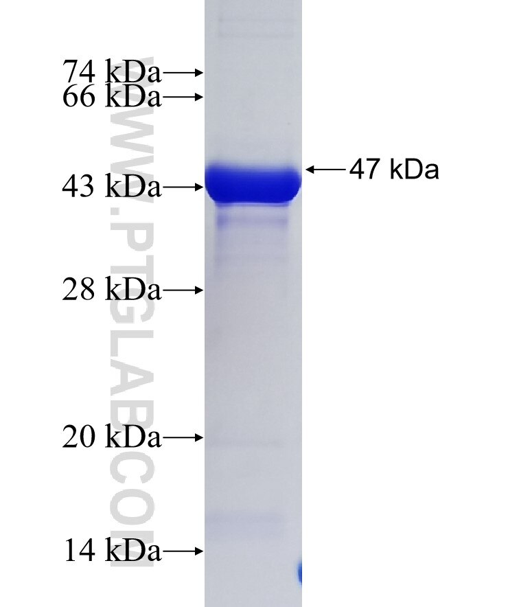 CDK5RAP2 fusion protein Ag36245 SDS-PAGE