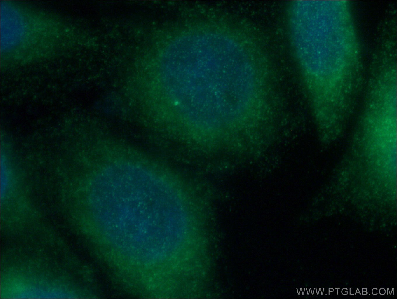 Immunofluorescence (IF) / fluorescent staining of HepG2 cells using CDK5RAP3 Polyclonal antibody (11007-1-AP)