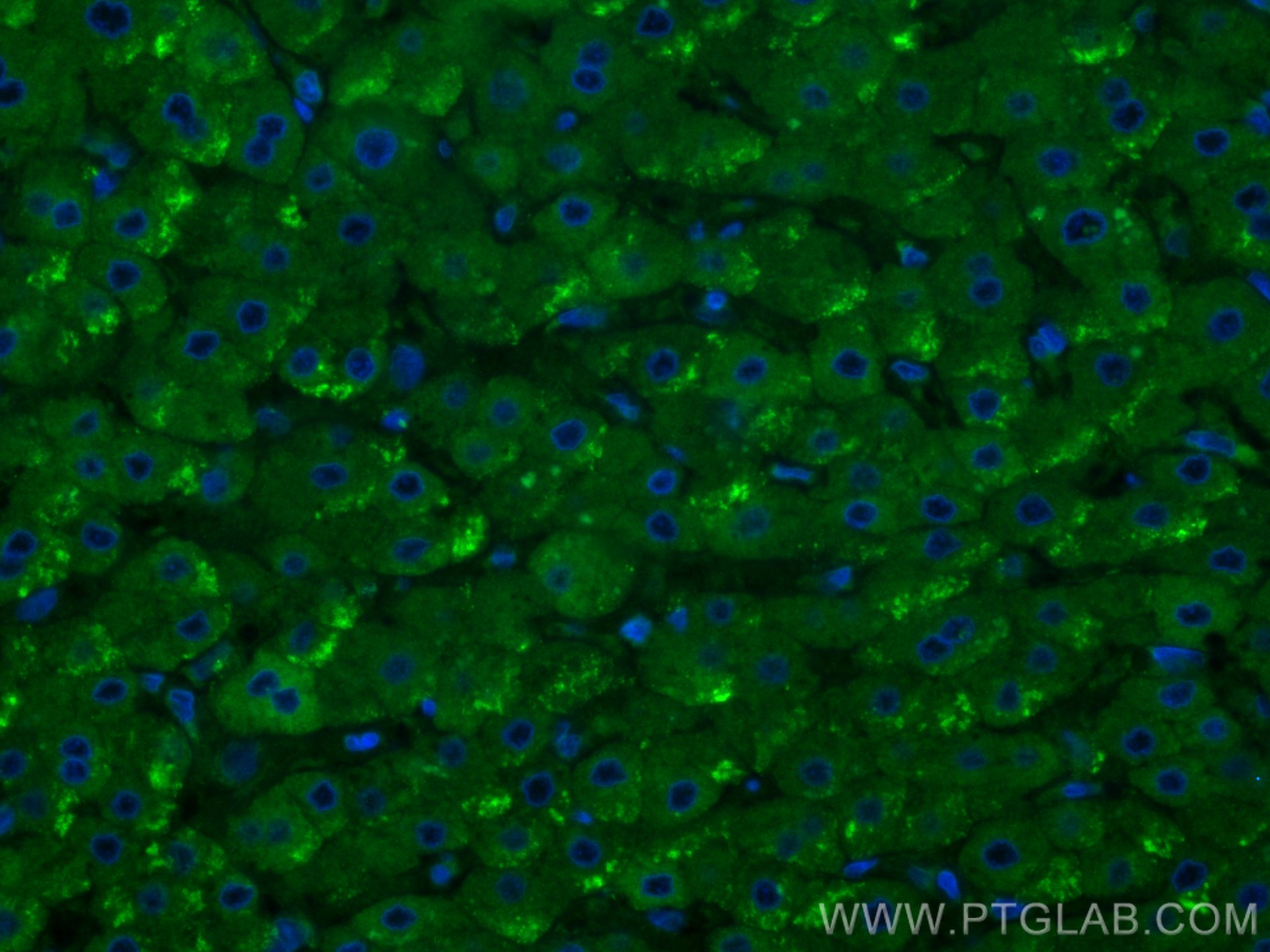 Immunofluorescence (IF) / fluorescent staining of human liver tissue using CDK5RAP3 Polyclonal antibody (11007-1-AP)