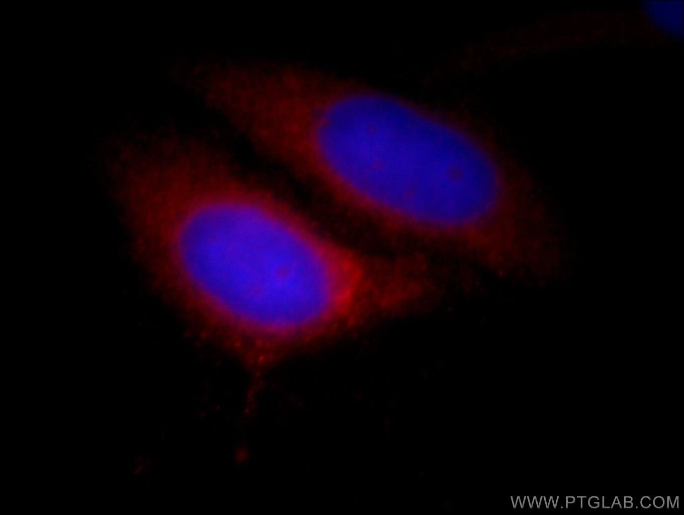 Immunofluorescence (IF) / fluorescent staining of HepG2 cells using CDK5RAP3 Polyclonal antibody (11007-1-AP)