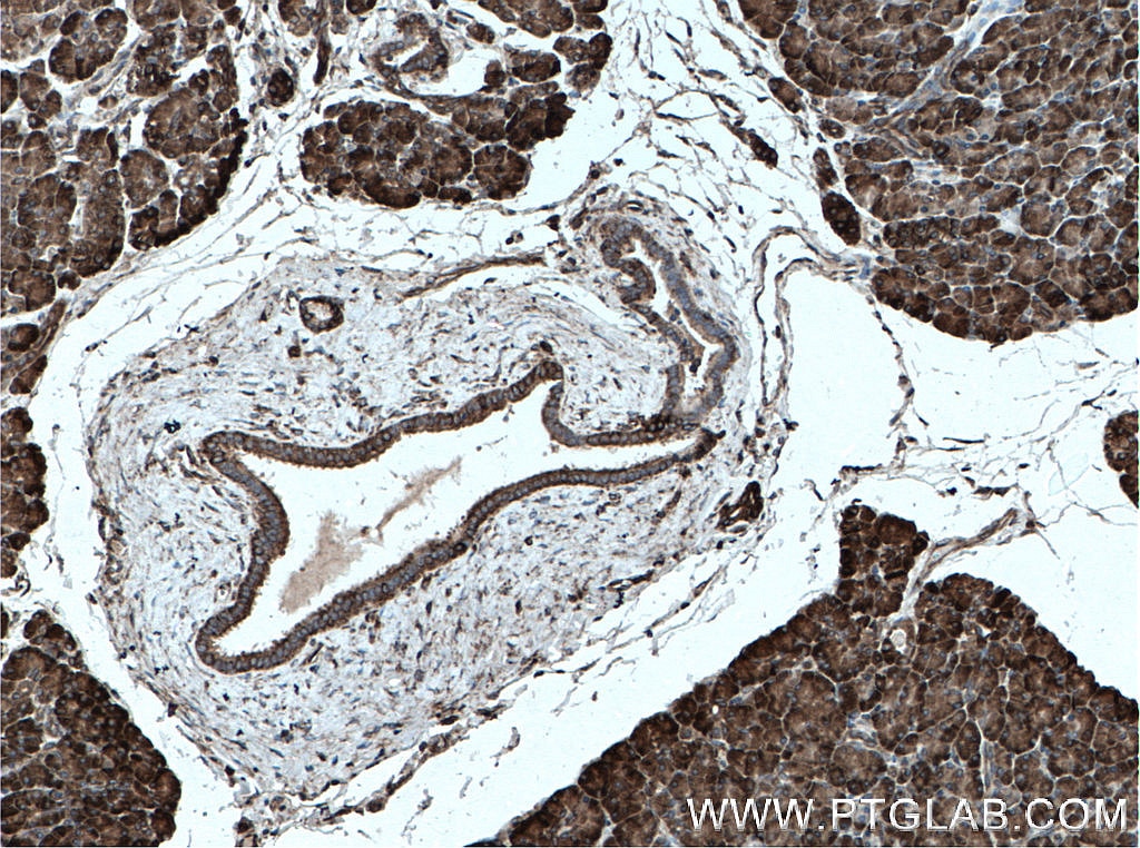 Immunohistochemistry (IHC) staining of human pancreas tissue using CDK5RAP3 Polyclonal antibody (11007-1-AP)