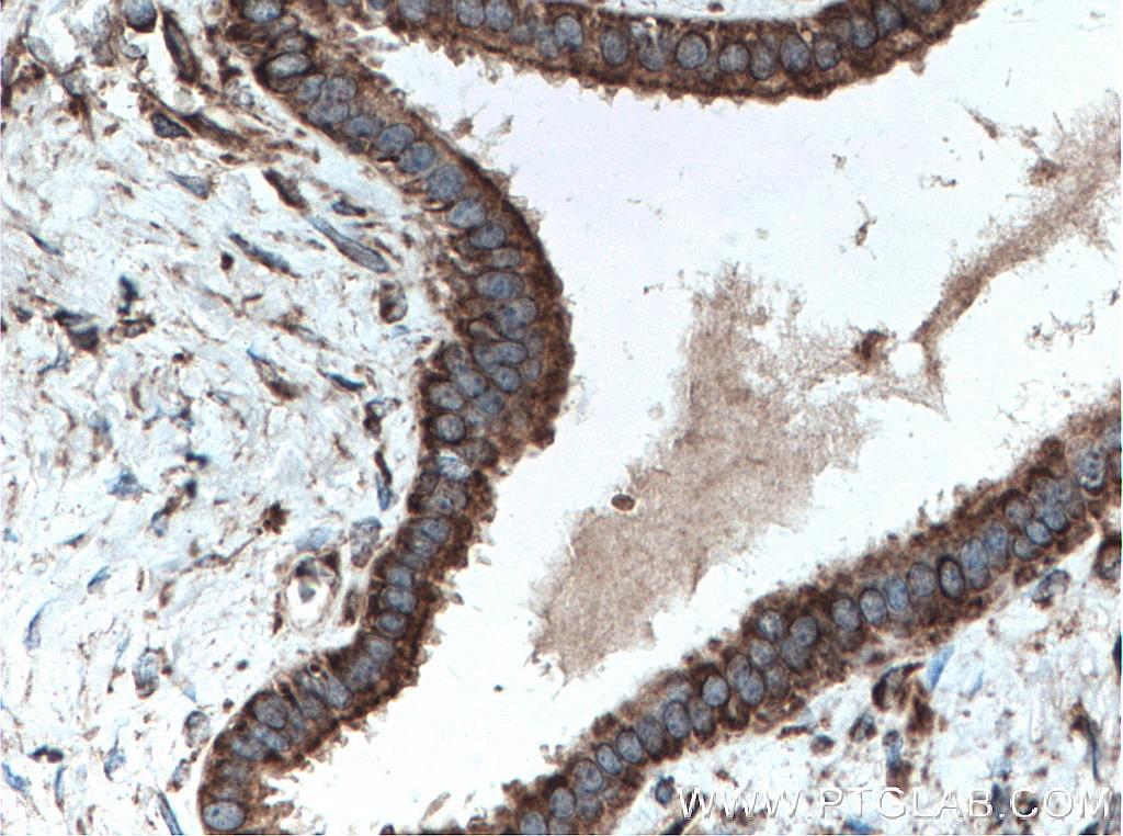 IHC staining of human pancreas using 11007-1-AP