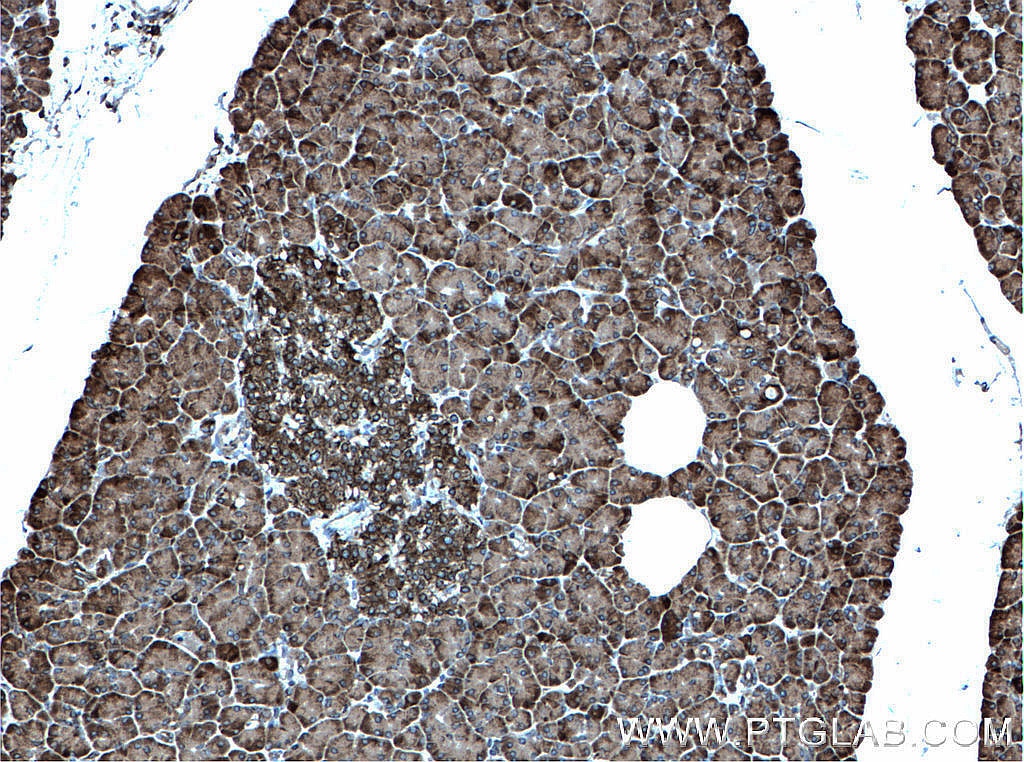 Immunohistochemistry (IHC) staining of human pancreas tissue using CDK5RAP3 Polyclonal antibody (11007-1-AP)