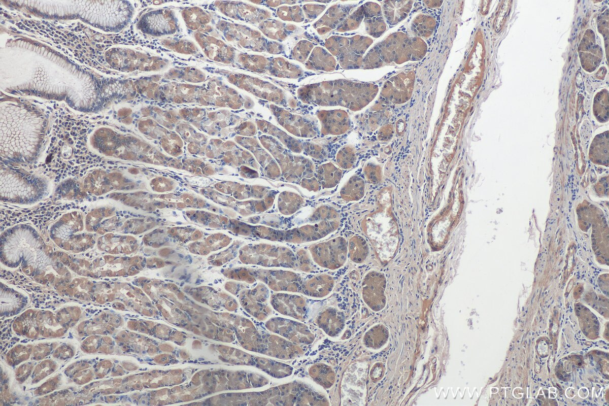 Immunohistochemistry (IHC) staining of human stomach tissue using CDK5RAP3 Polyclonal antibody (11007-1-AP)