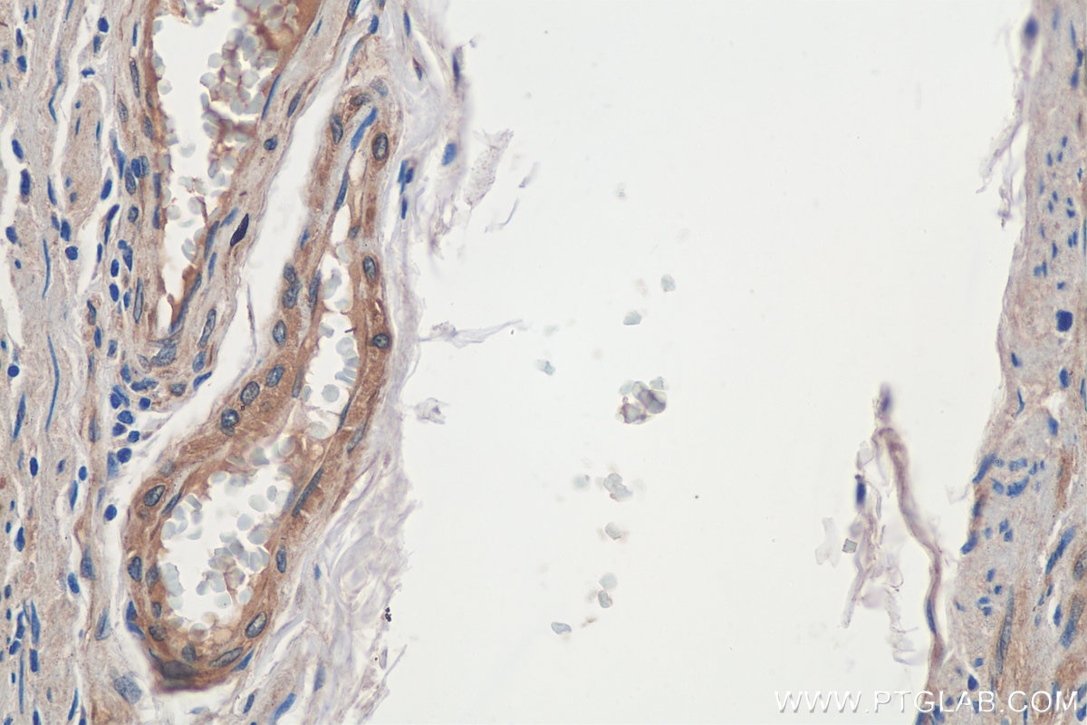 Immunohistochemistry (IHC) staining of human stomach tissue using CDK5RAP3 Polyclonal antibody (11007-1-AP)