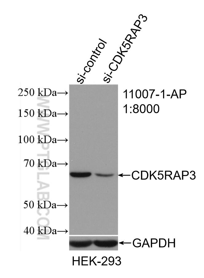 Western Blot (WB) analysis of HEK-293 cells using CDK5RAP3 Polyclonal antibody (11007-1-AP)