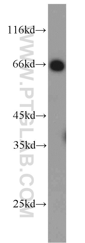 Western Blot (WB) analysis of A431 cells using CDK5RAP3 Polyclonal antibody (11007-1-AP)
