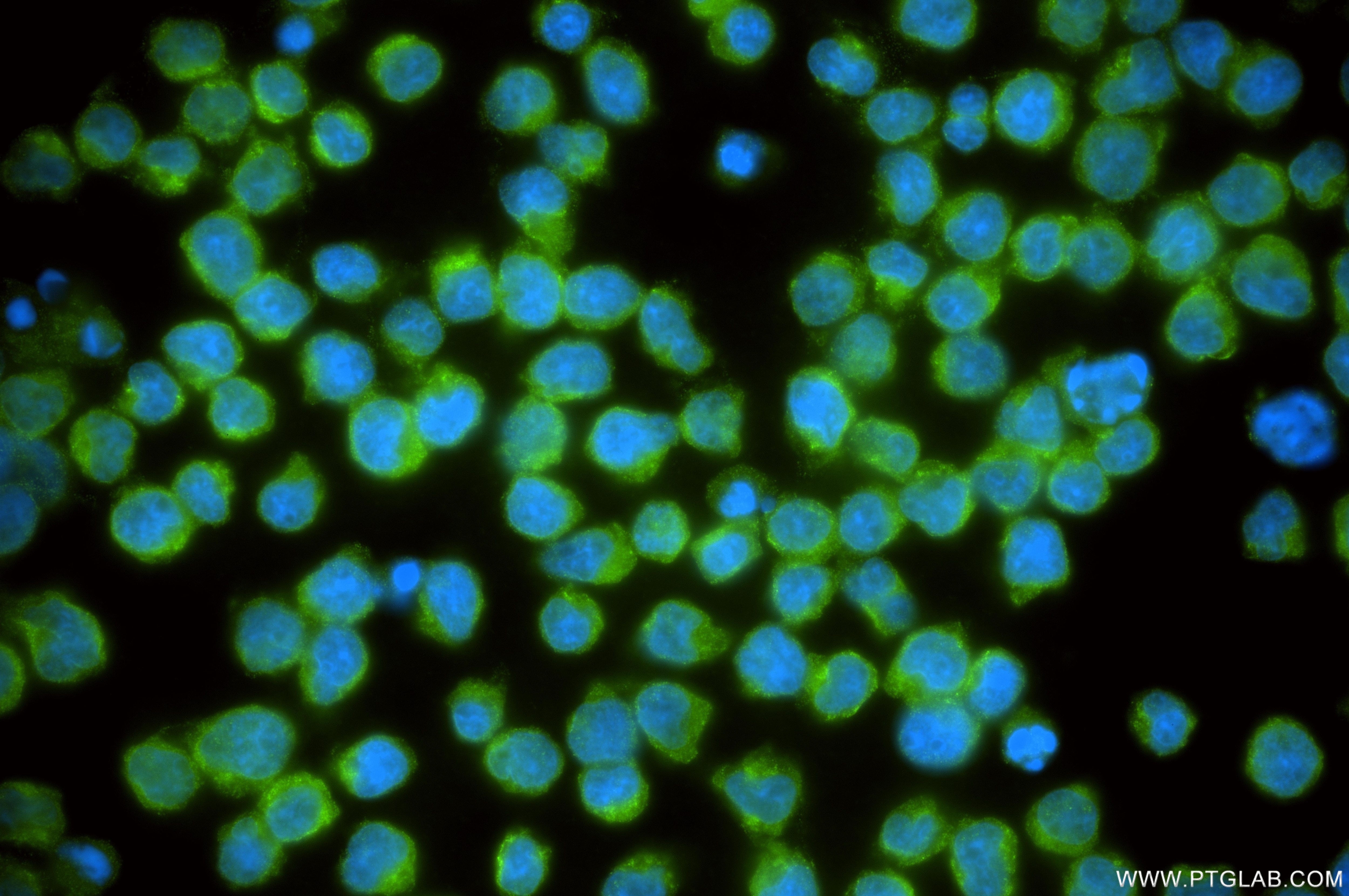 Immunofluorescence (IF) / fluorescent staining of Jurkat cells using CDK5RAP3 Recombinant monoclonal antibody (86177-1-RR)