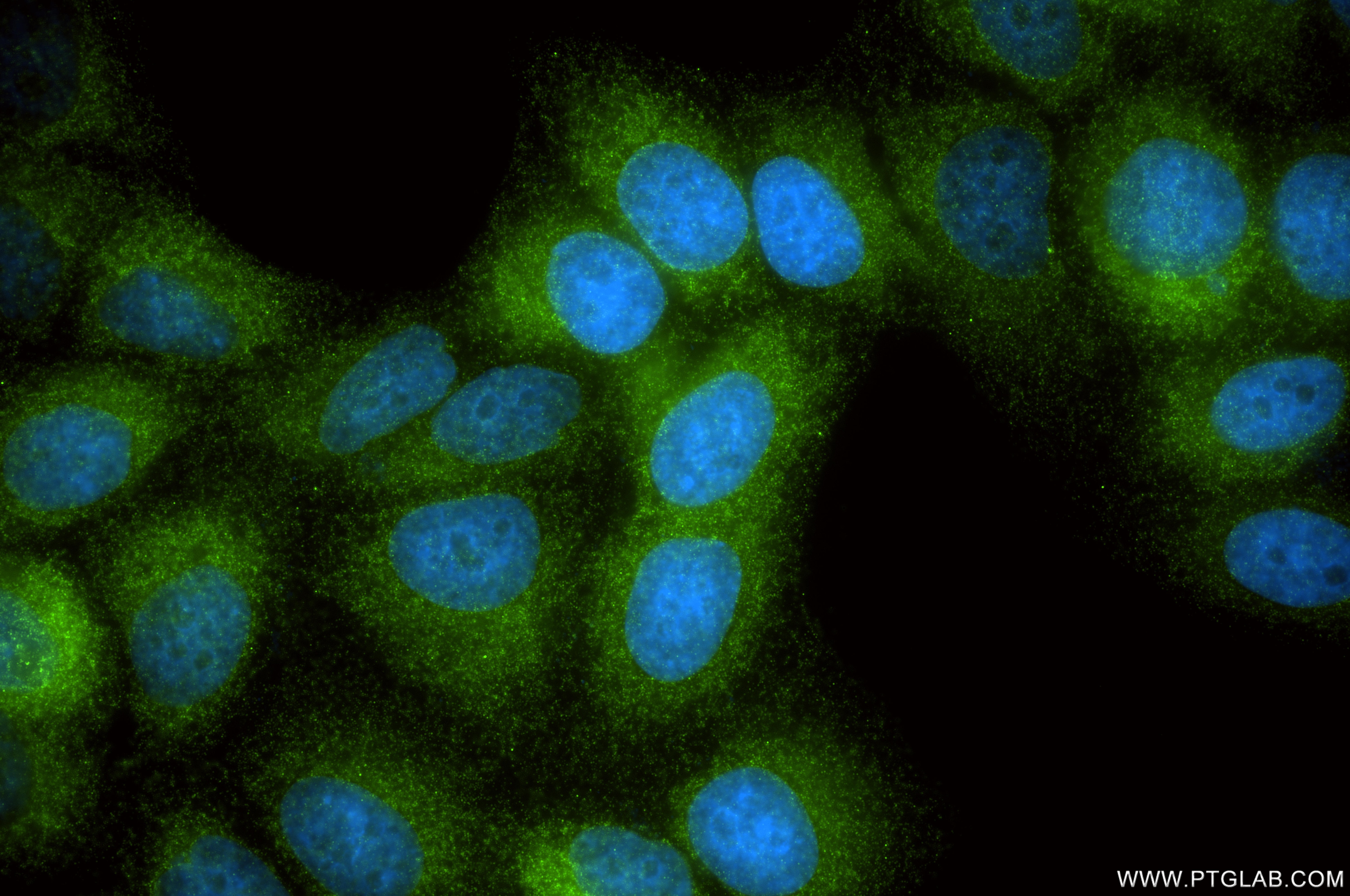 Immunofluorescence (IF) / fluorescent staining of HepG2 cells using CDK5RAP3 Recombinant monoclonal antibody (86177-2-RR)