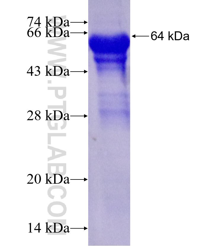 CDK5RAP3 fusion protein Ag1474 SDS-PAGE