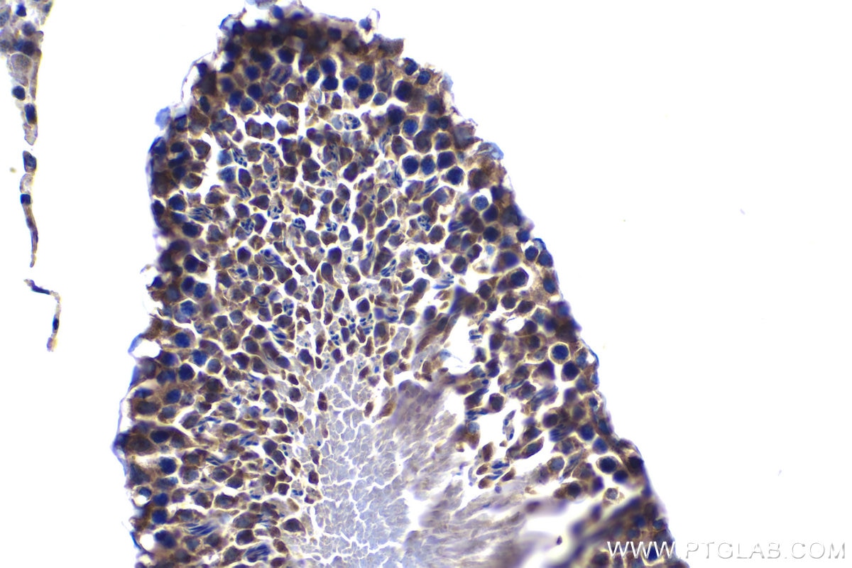 Immunohistochemistry (IHC) staining of rat testis tissue using CDK6 Polyclonal antibody (14052-1-AP)