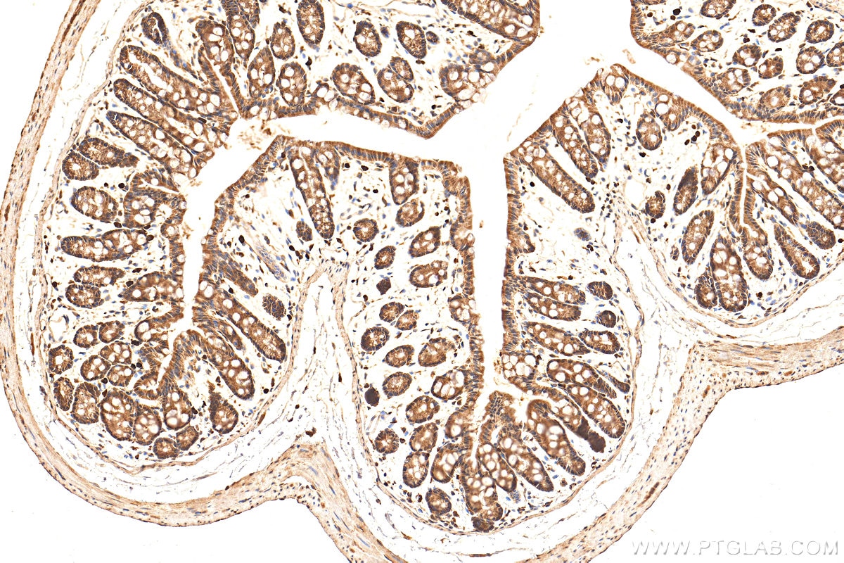 Immunohistochemistry (IHC) staining of mouse colon tissue using CDK6 Polyclonal antibody (14052-1-AP)