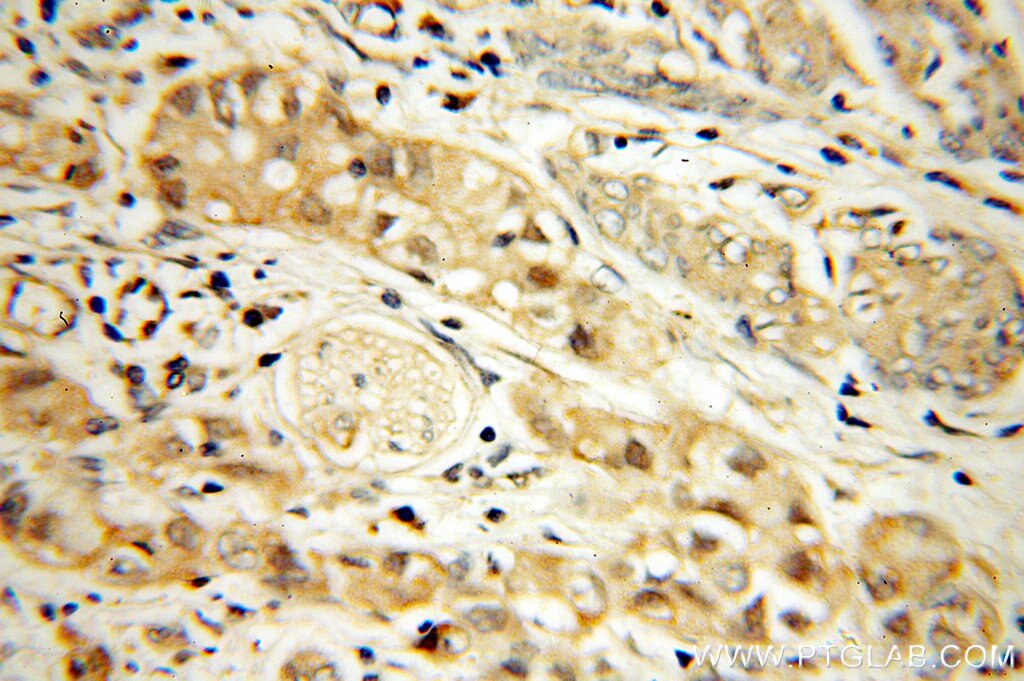 CDK6 Polyclonal antibody