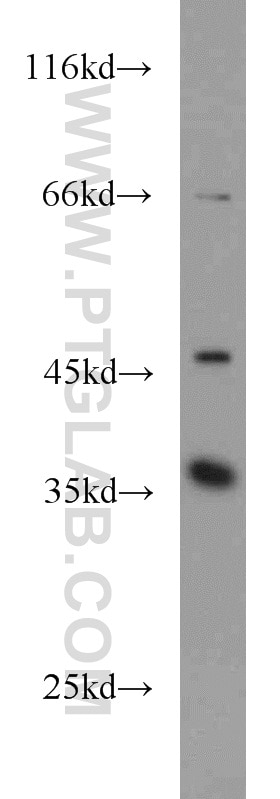 CDK6 Polyclonal antibody