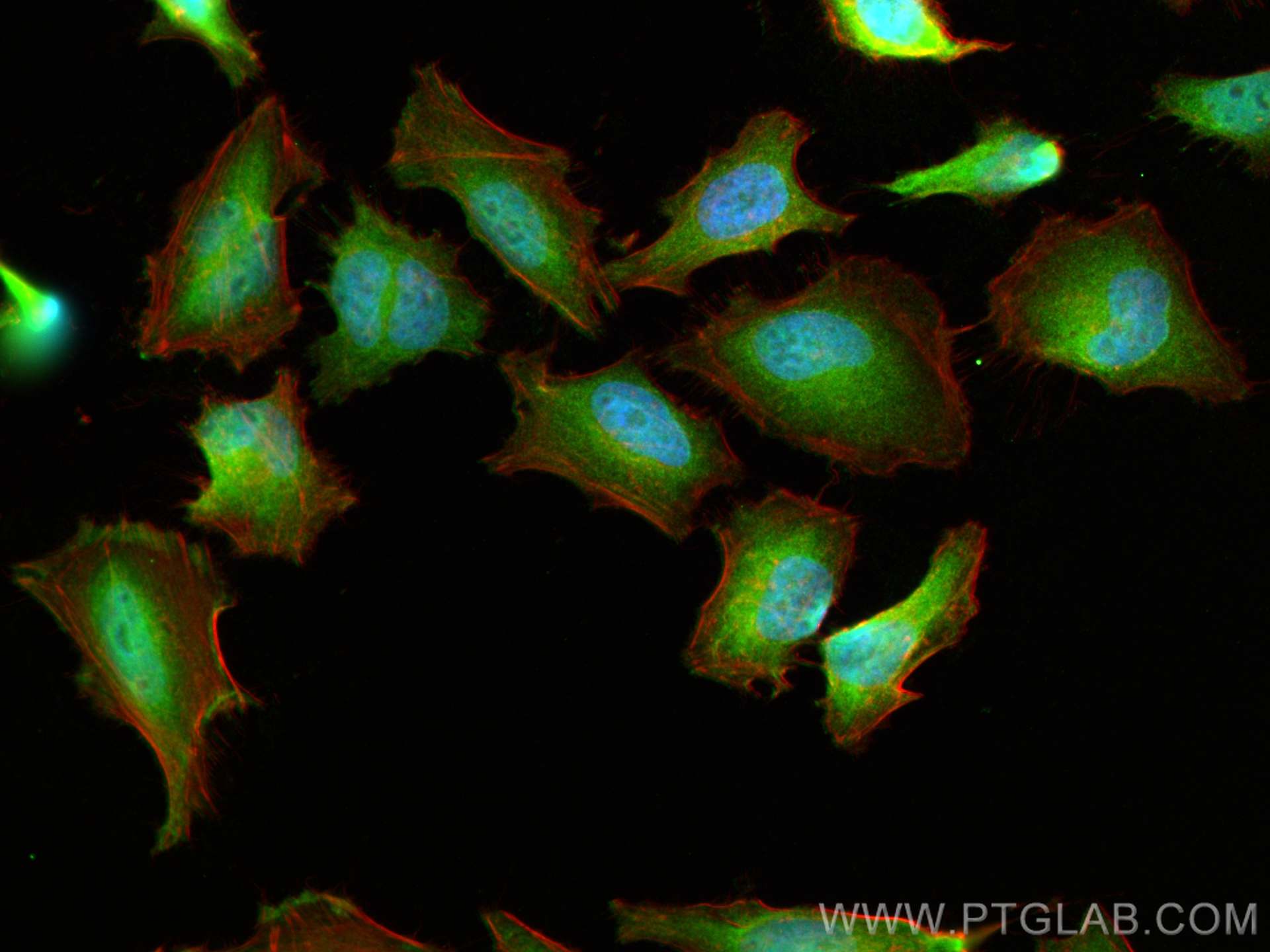 Immunofluorescence (IF) / fluorescent staining of HeLa cells using CDK6 Polyclonal antibody (19117-1-AP)