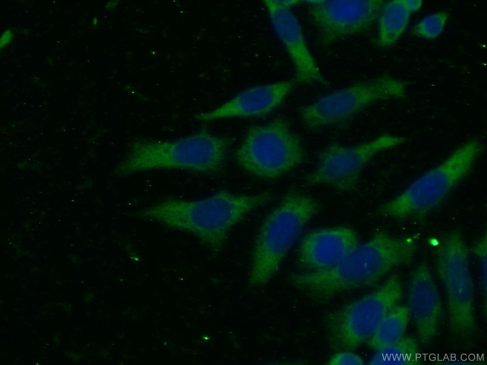 Immunofluorescence (IF) / fluorescent staining of HeLa cells using CDK6 Monoclonal antibody (66278-1-Ig)