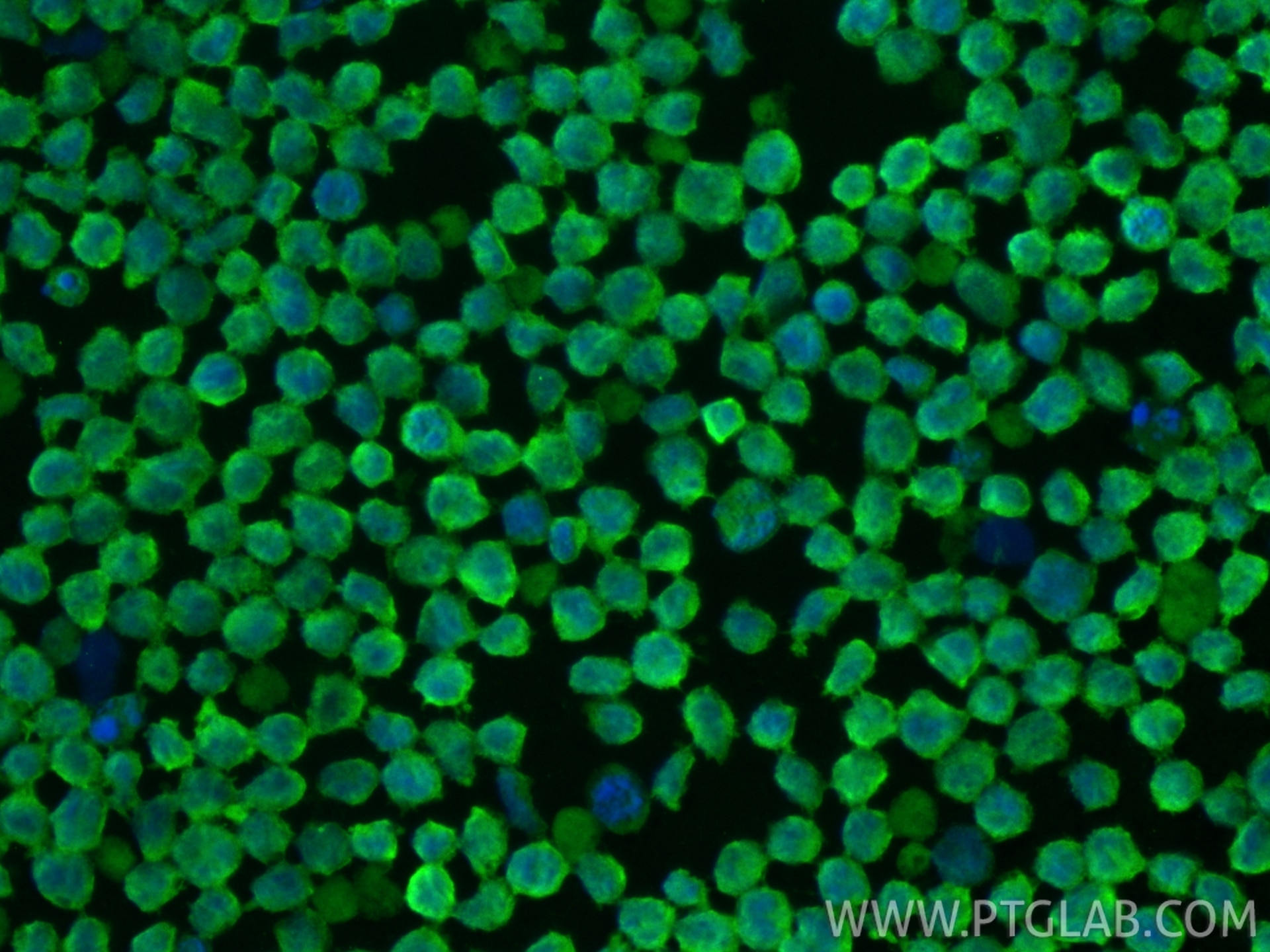 Immunofluorescence (IF) / fluorescent staining of MOLT-4 cells using CDK6 Monoclonal antibody (66278-1-Ig)