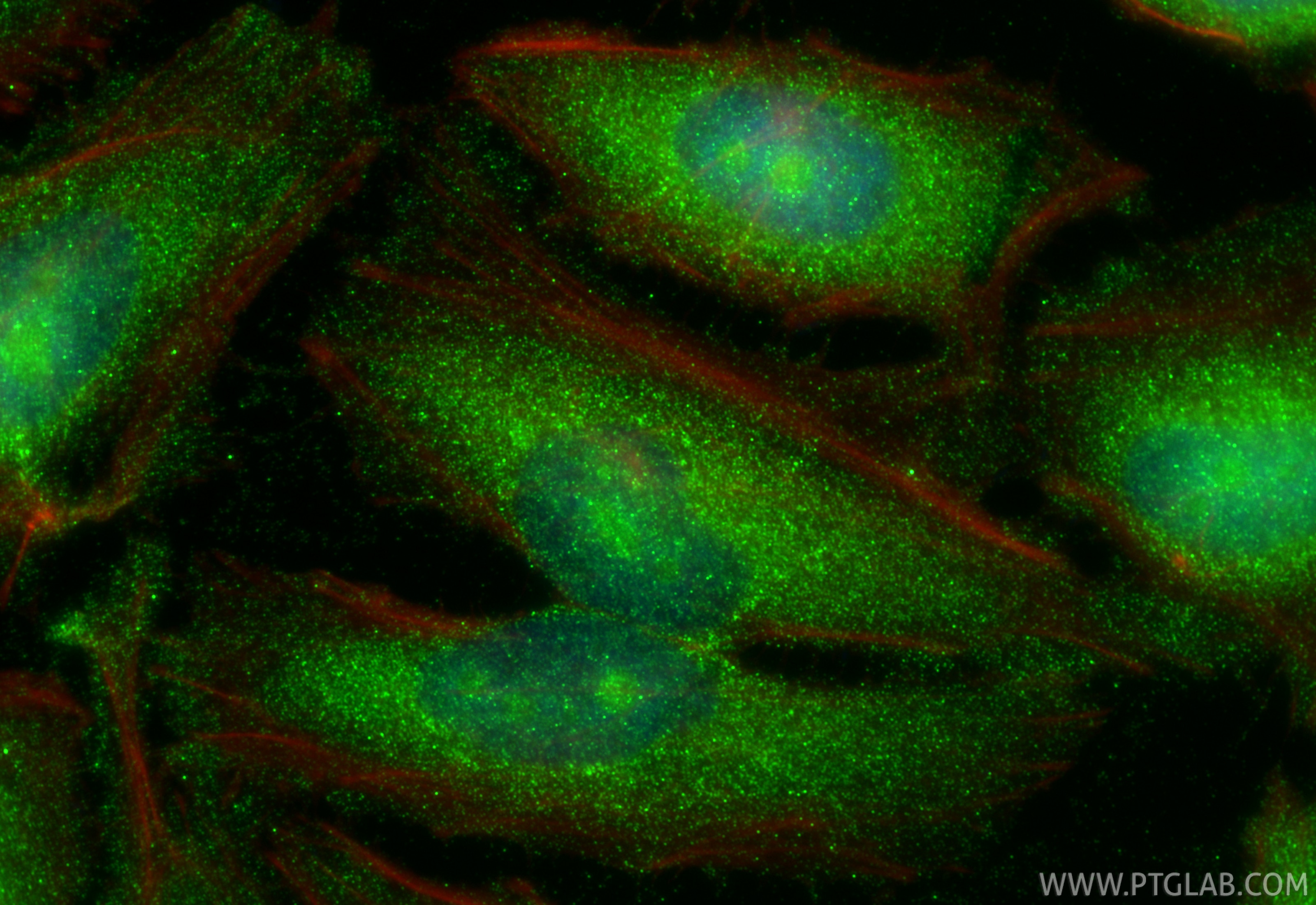 IF Staining of HeLa using 66278-1-Ig Immunofluorescence (IF) / fluorescent staining of HeLa cells using CDK6 Monoclonal antibody (66278-1-Ig)