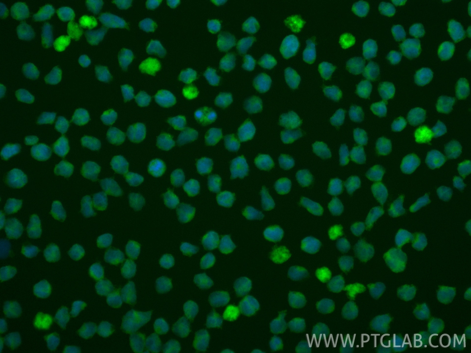 Immunofluorescence (IF) / fluorescent staining of MOLT-4 cells using CoraLite® Plus 488-conjugated CDK6 Monoclonal anti (CL488-66278)