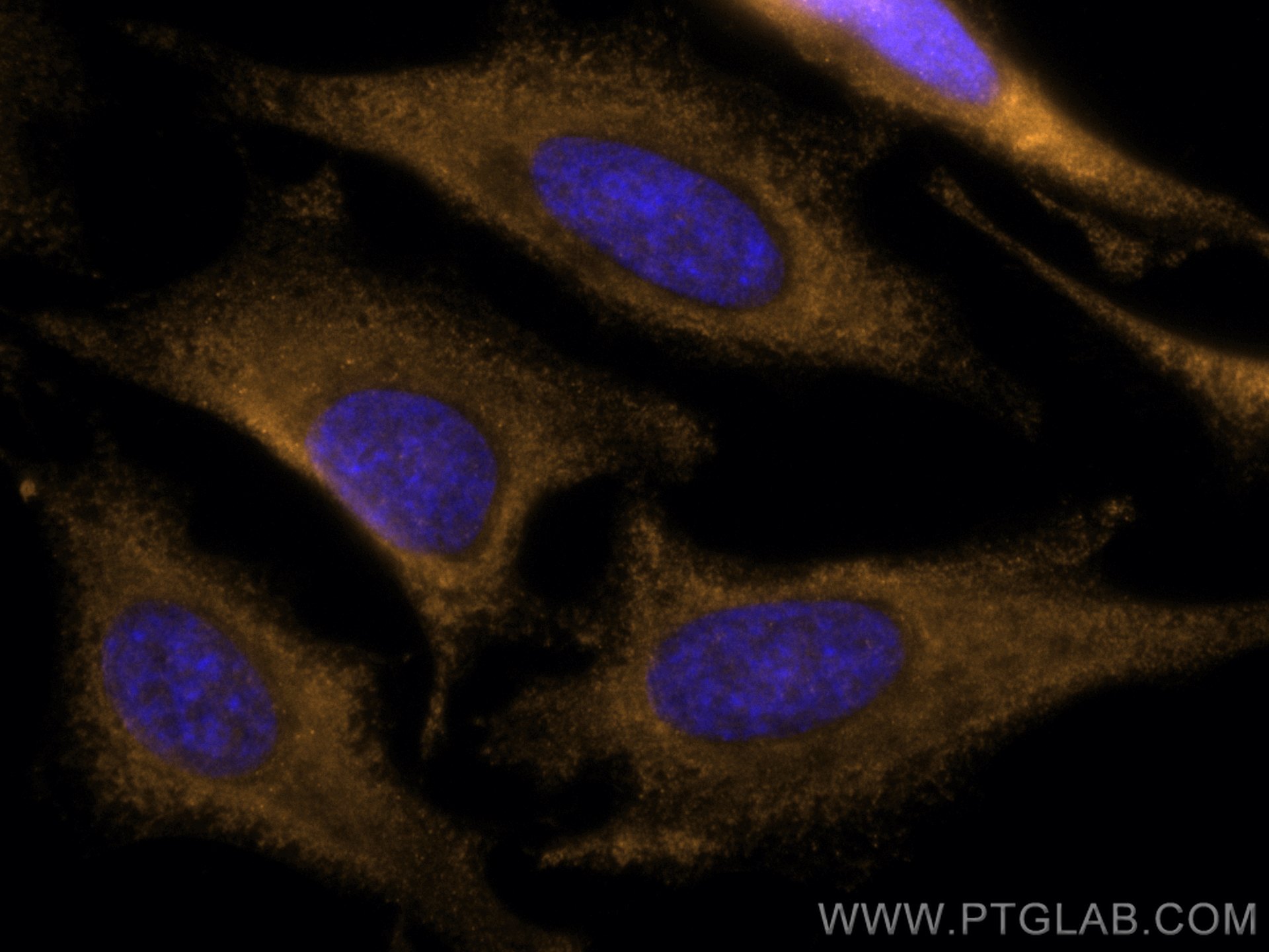 Immunofluorescence (IF) / fluorescent staining of HeLa cells using CoraLite®555-conjugated CDK6 Monoclonal antibody (CL555-66278)