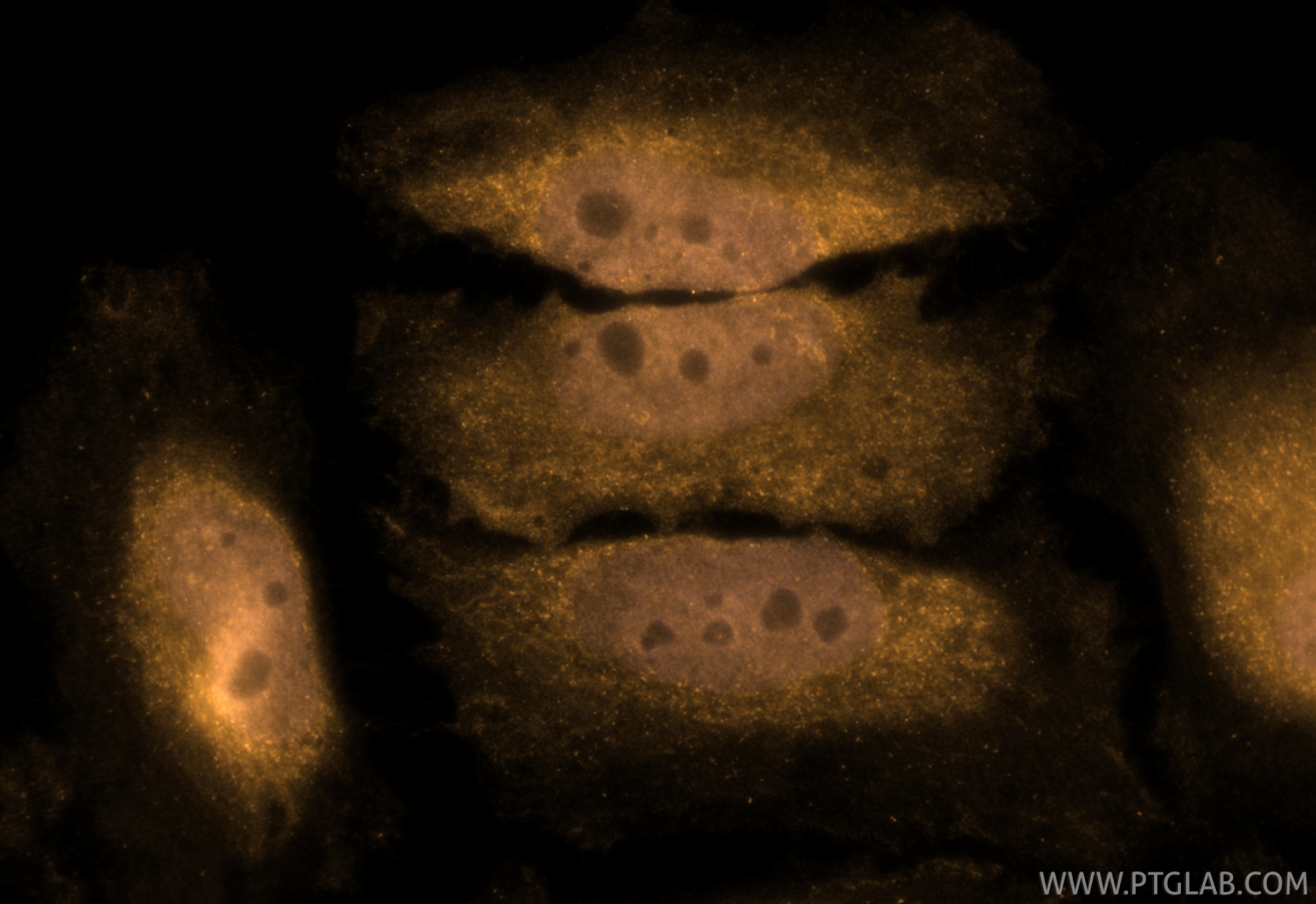 IF Staining of HeLa using CL555-66278 Immunofluorescence (IF) / fluorescent staining of HeLa cells using CoraLite®555-conjugated CDK6 Monoclonal antibody (CL555-66278)