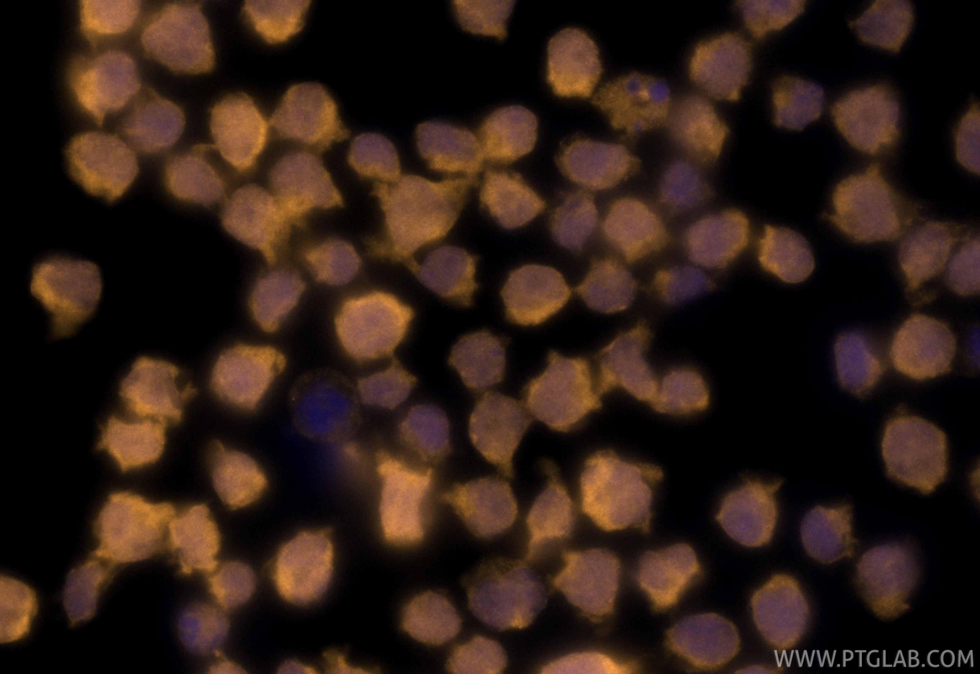 Immunofluorescence (IF) / fluorescent staining of Jurkat cells using CoraLite®555-conjugated CDK6 Monoclonal antibody (CL555-66278)