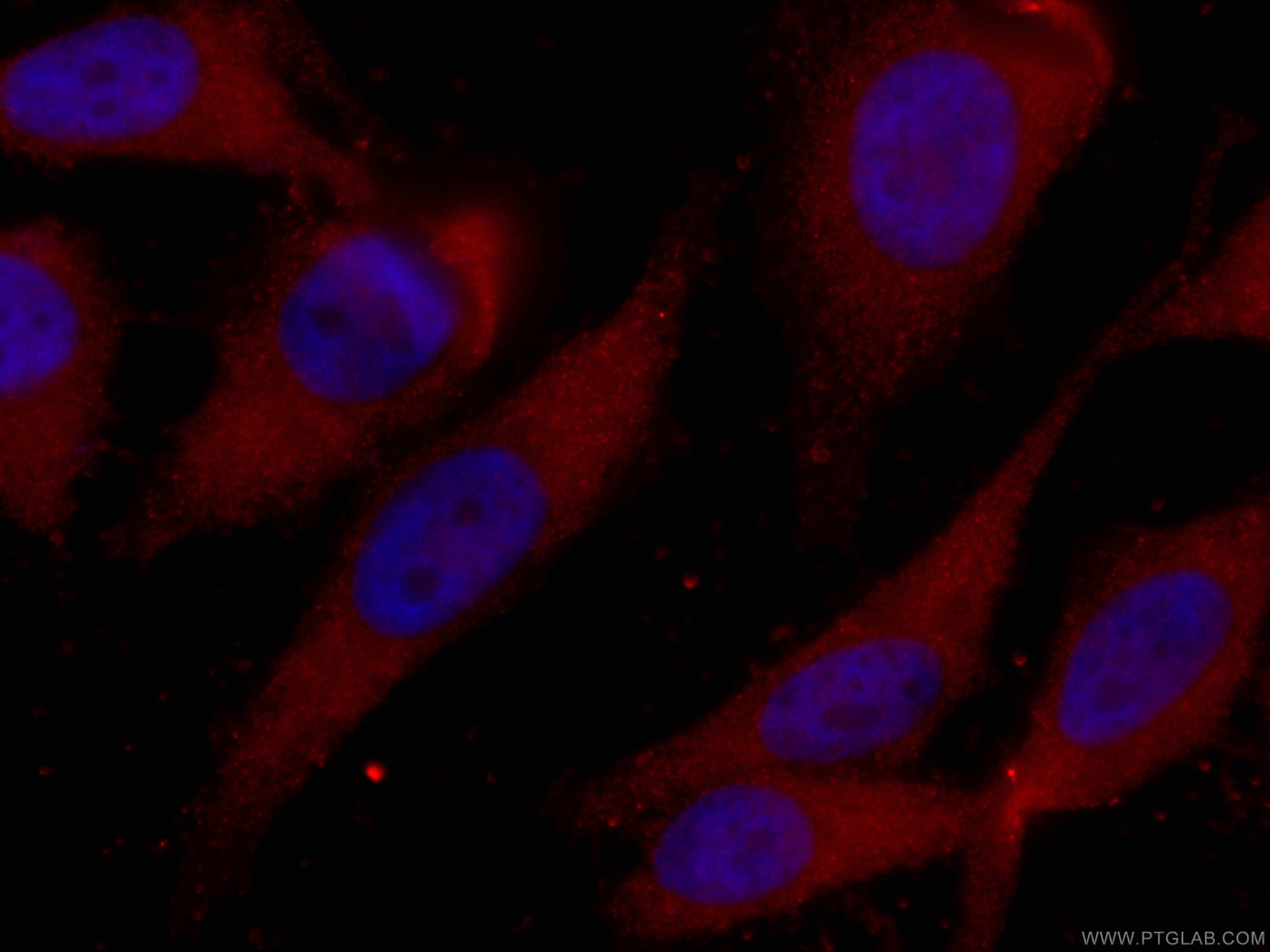 Immunofluorescence (IF) / fluorescent staining of HeLa cells using CoraLite®594-conjugated CDK6 Monoclonal antibody (CL594-66278)
