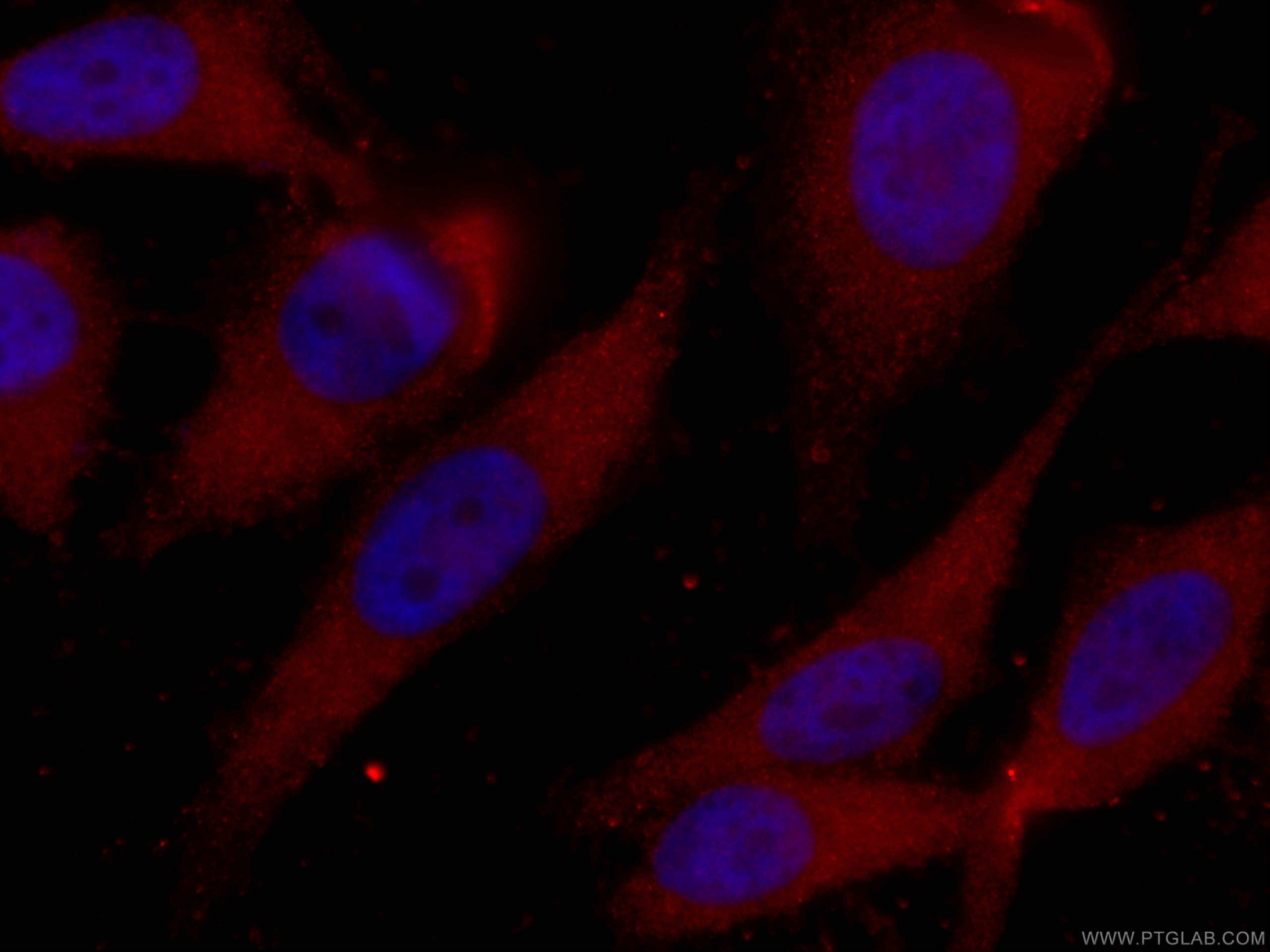 IF Staining of HeLa using CL594-66278