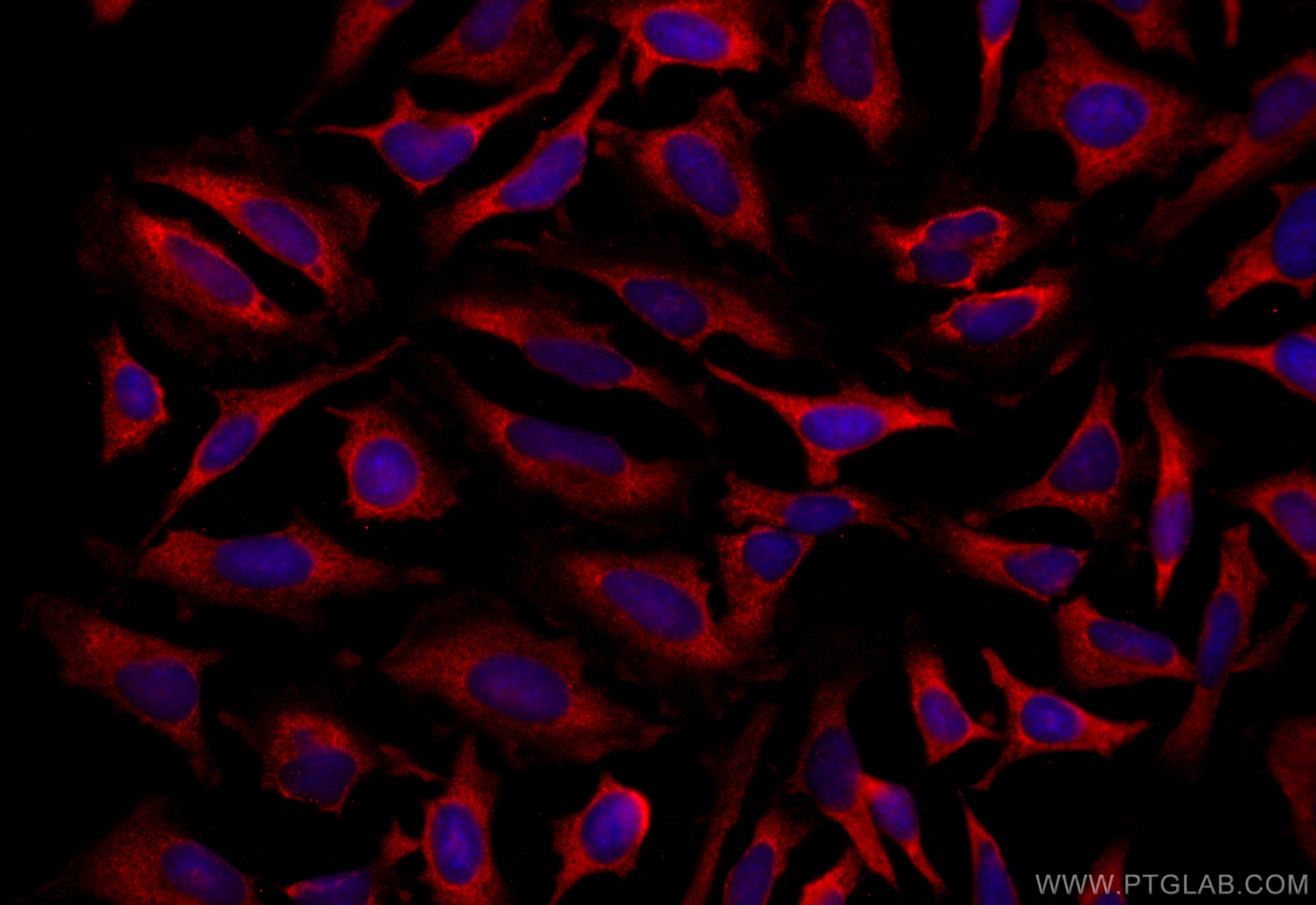 Immunofluorescence (IF) / fluorescent staining of HeLa cells using CoraLite®594-conjugated CDK6 Monoclonal antibody (CL594-66278)