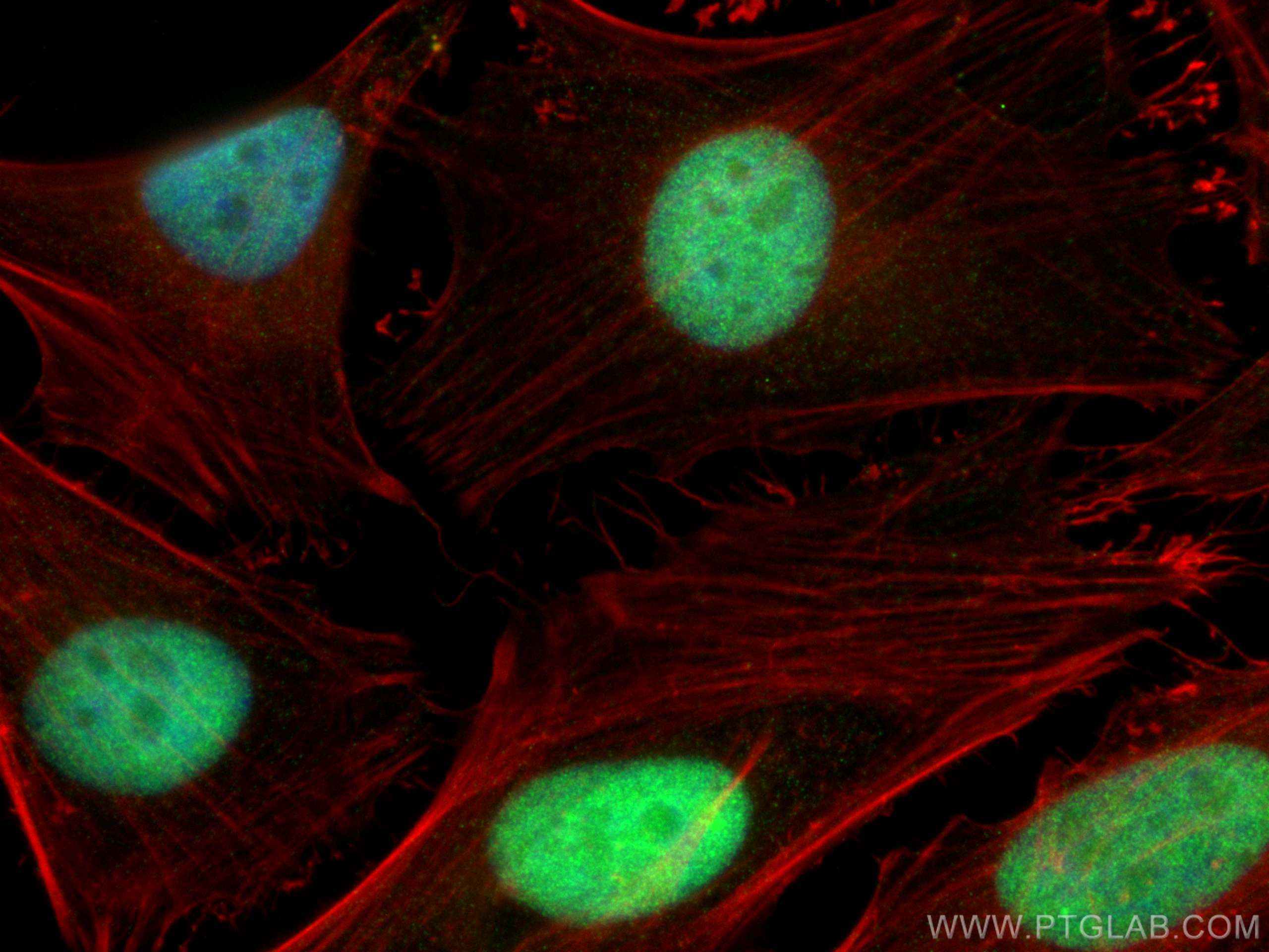Immunofluorescence (IF) / fluorescent staining of HeLa cells using CDK7 Monoclonal antibody (67889-1-Ig)