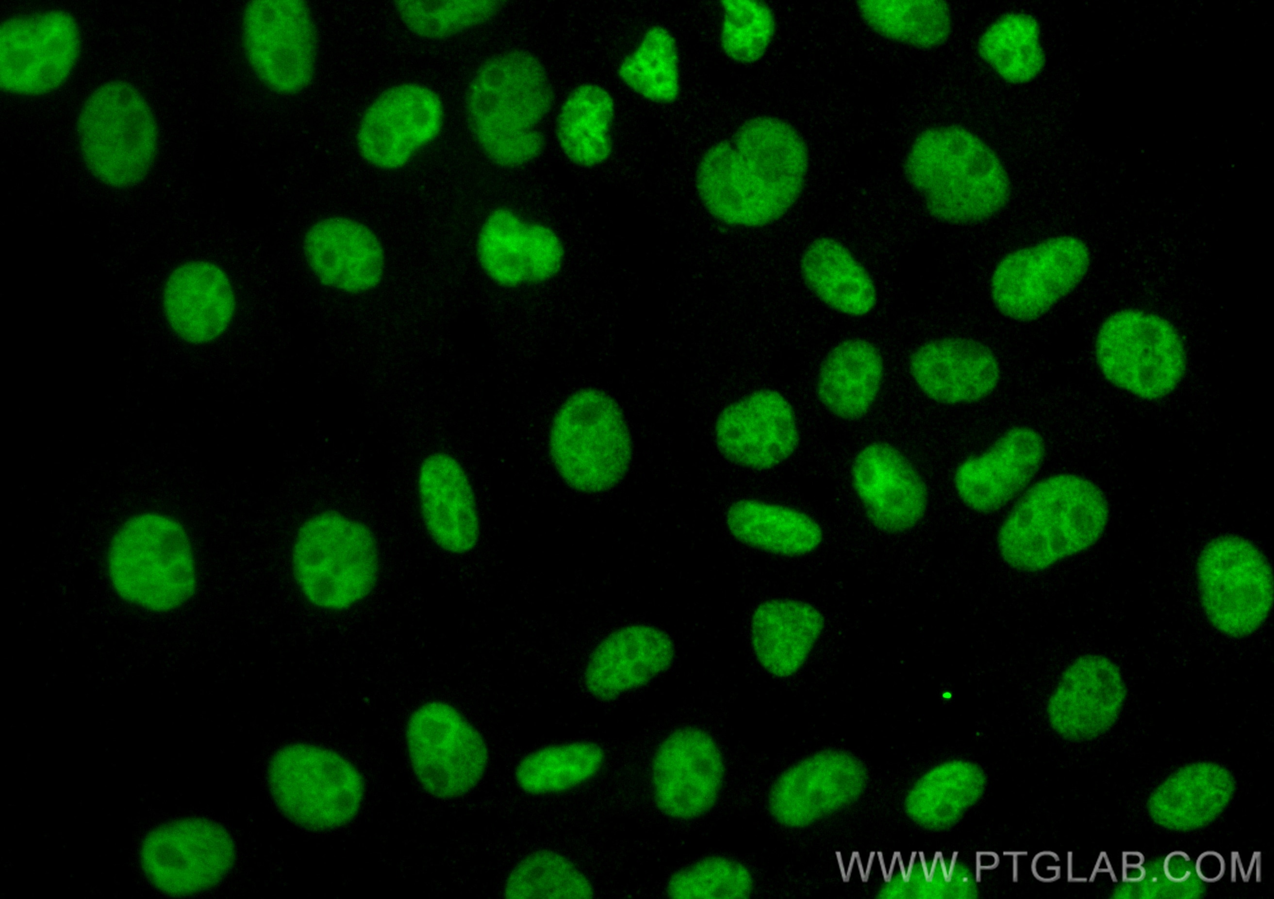 Immunofluorescence (IF) / fluorescent staining of A431 cells using CDK7 Monoclonal antibody (67889-1-Ig)