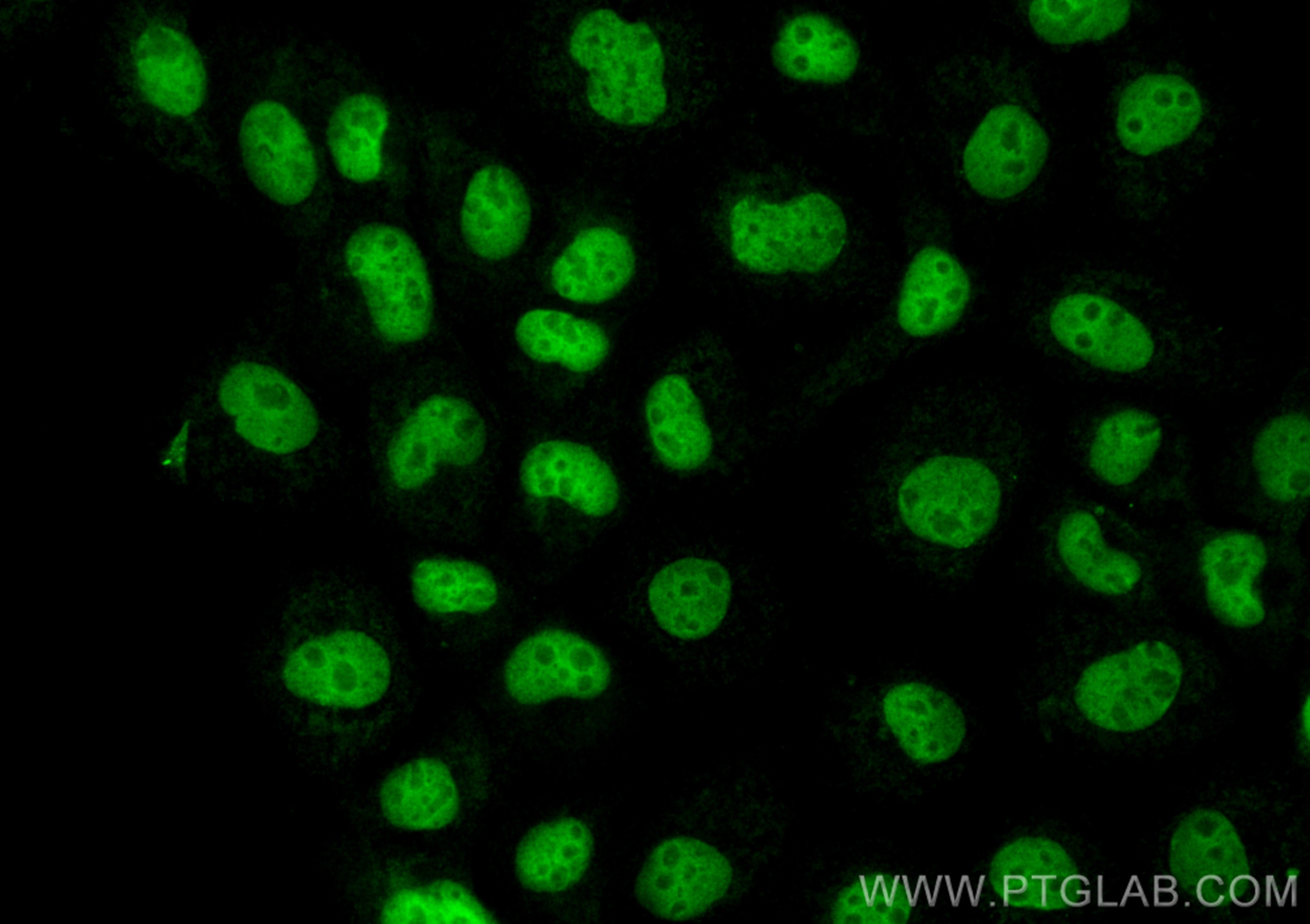 Immunofluorescence (IF) / fluorescent staining of A431 cells using CoraLite® Plus 488-conjugated CDK7 Monoclonal anti (CL488-67889)