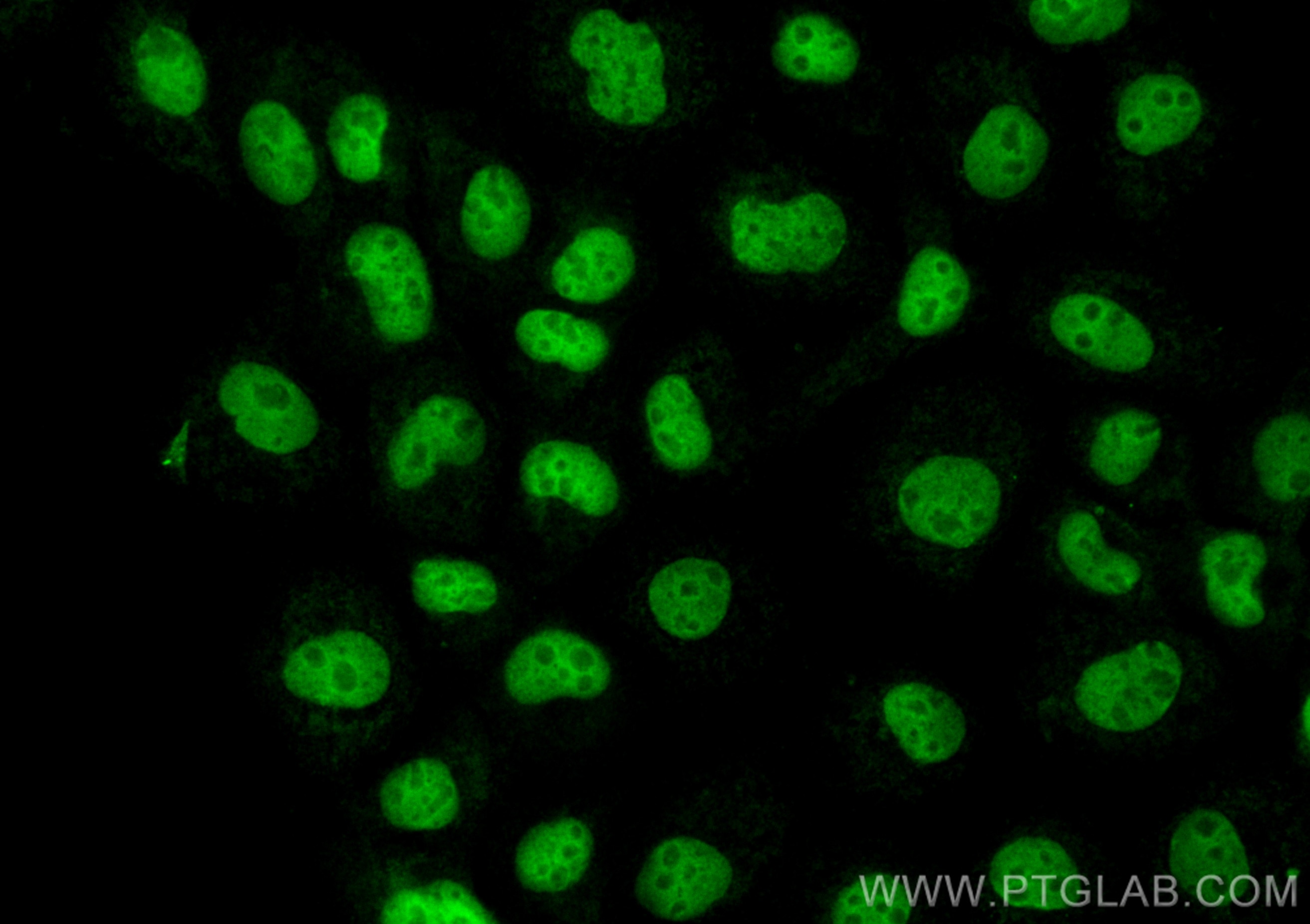 IF Staining of A431 using CL488-67889